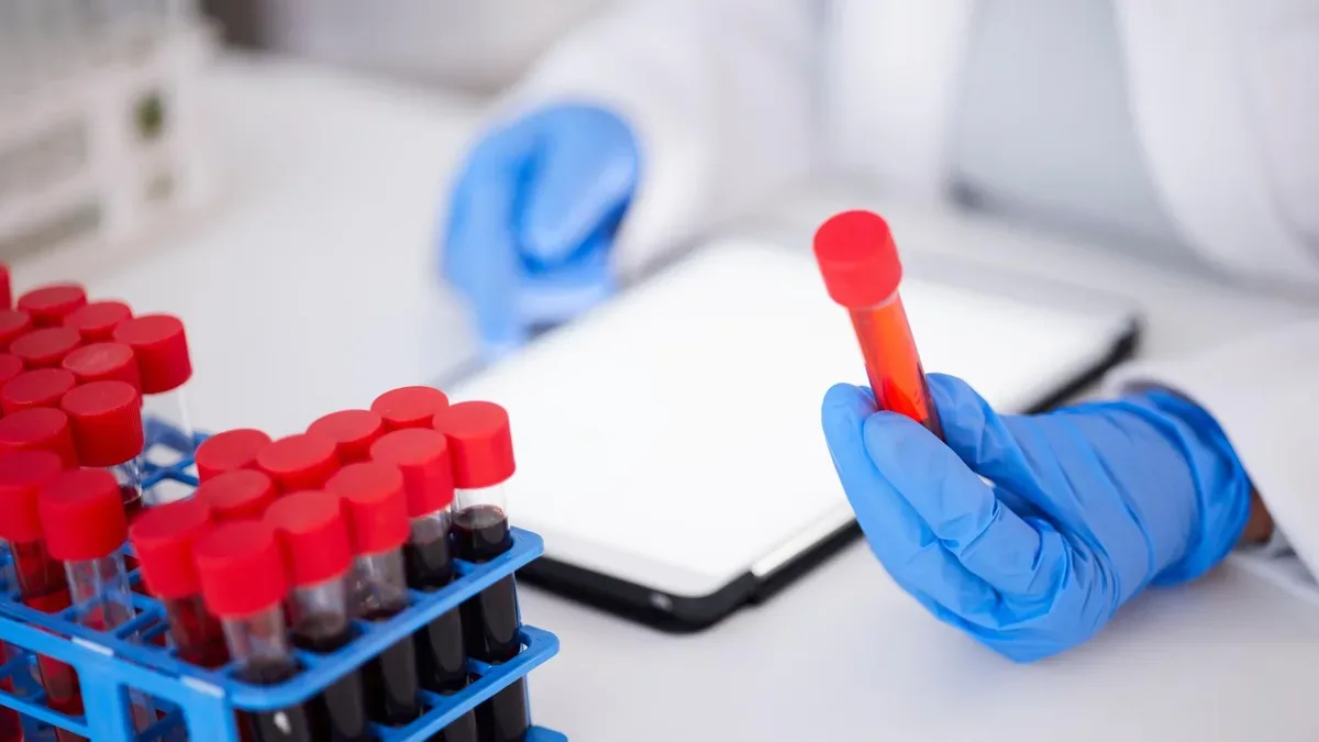 Tubo con muestra de sangre en laboratorio para análisis de troponina y diagnóstico de infarto